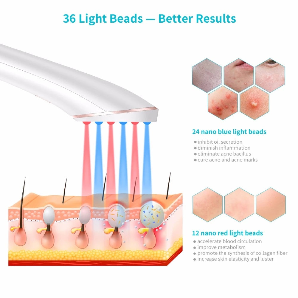 Acne Light Therapy Acne Treatment Device