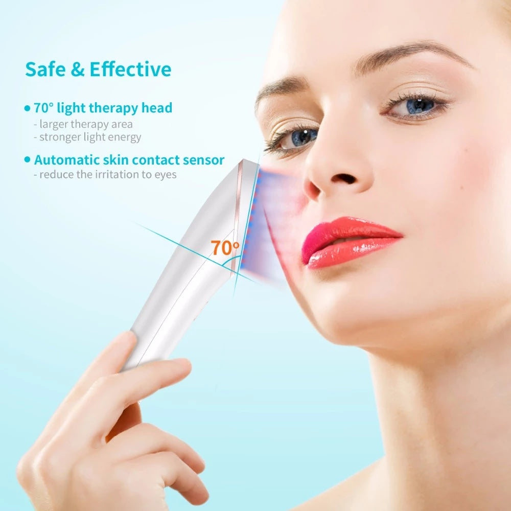 Acne Light Therapy Acne Treatment Device